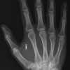 RFID_In_Hand